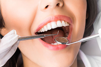 A woman with her mouth open wide, receiving dental treatment from a professional, emphasizing oral hygiene and dental care services.