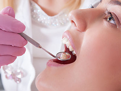 An individual receiving dental care, with a dental professional using a drill on their teeth.